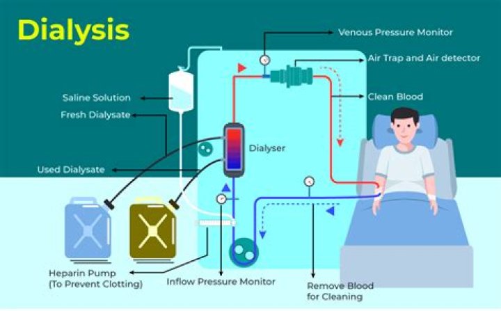 Do dialysis patients ever get off dialysis?