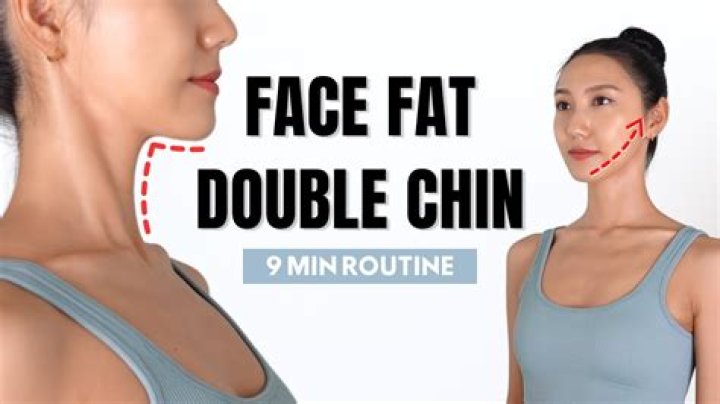 Do double chins go away?