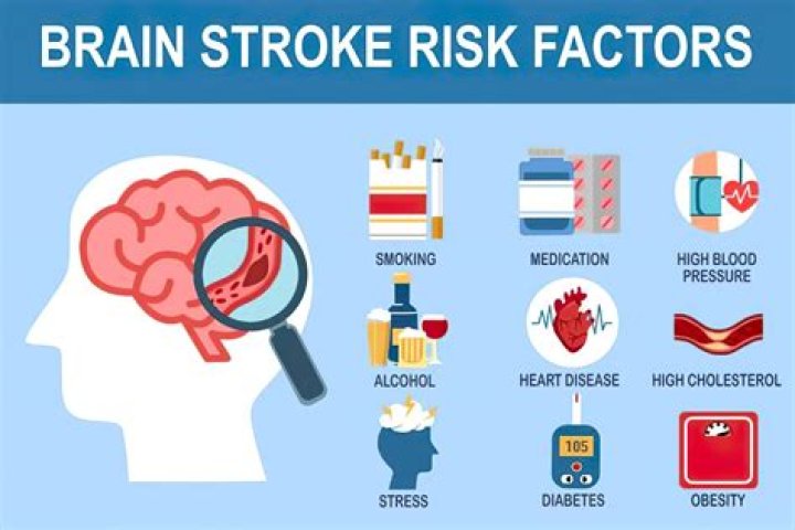 Do statins Increase risk of stroke?