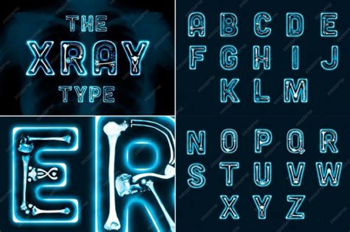 Do they xray letters?