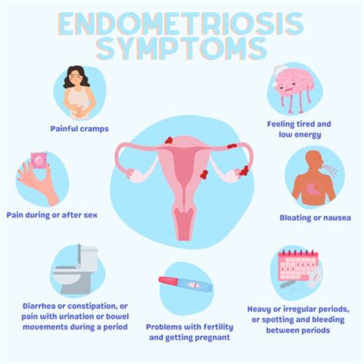 Do you bleed internally with endometriosis?
