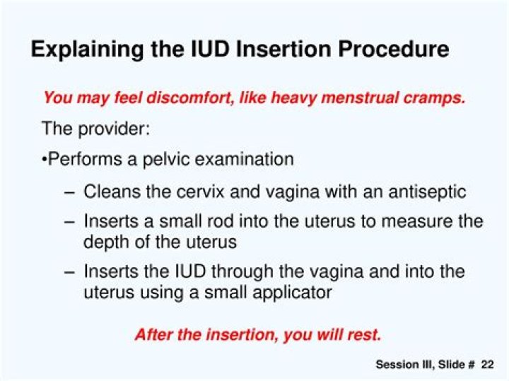 Do you need to rest after IUD insertion?