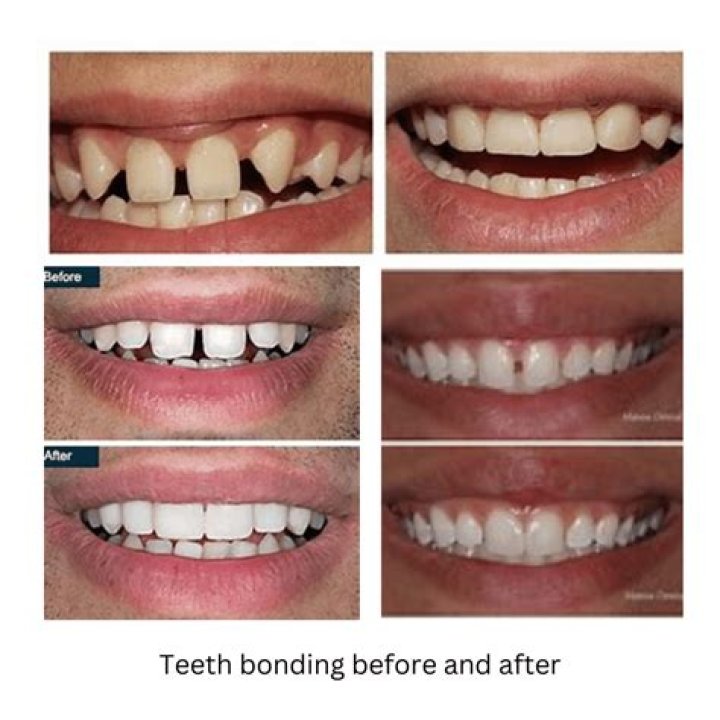 Do you rinse after Sensodyne?