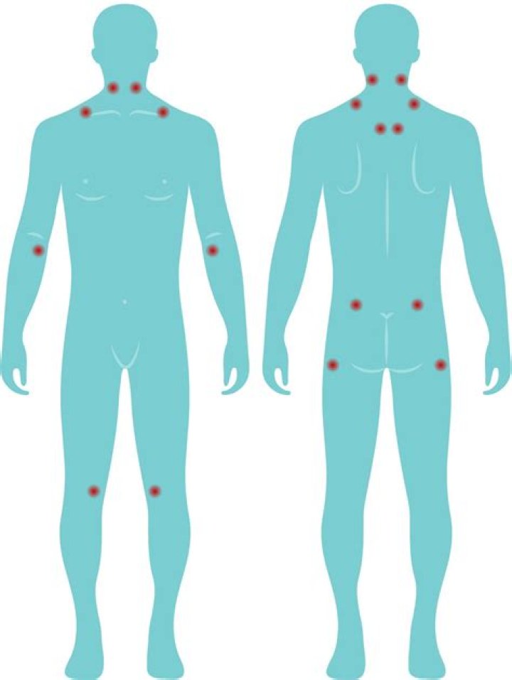 Does a hot bath help fibromyalgia?