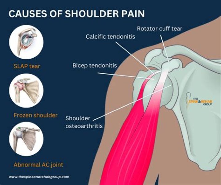 Does anxiety cause shoulder and arm pain?