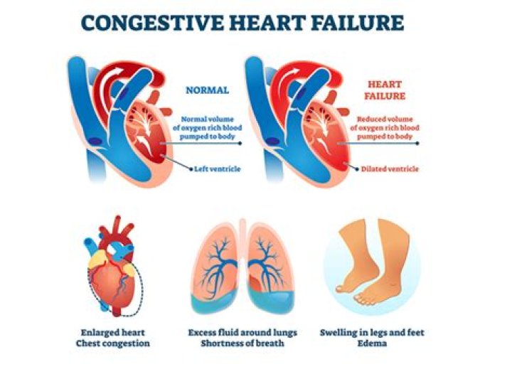 Does congestive heart failure show up in blood work?