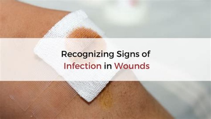 Does ear drainage mean infection is healing?