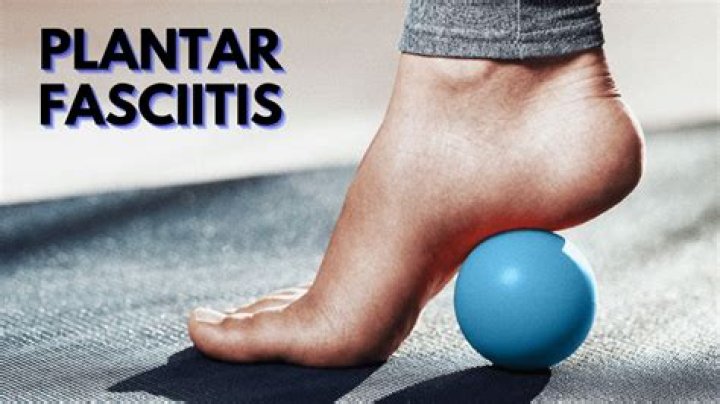 Does Elevating your feet help with plantar fasciitis?