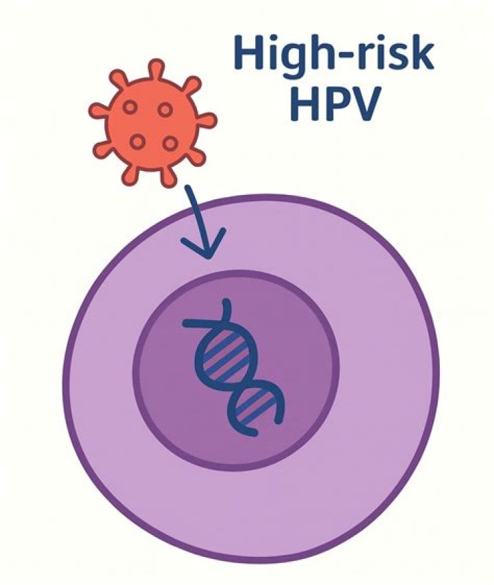 Does high risk HPV go away?