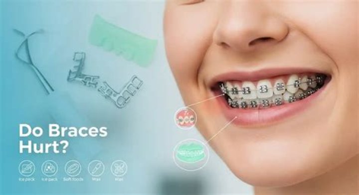Does it hurt to have braces removed?