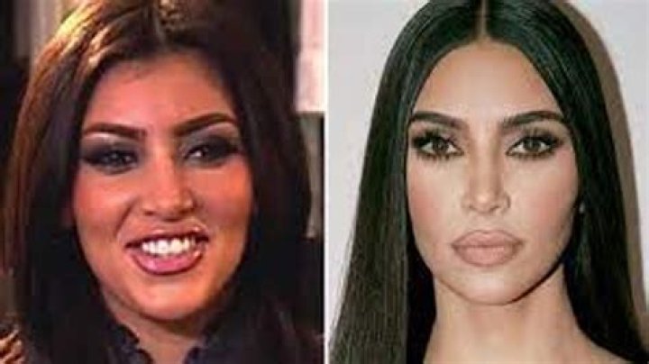 Does Kim K use filler?