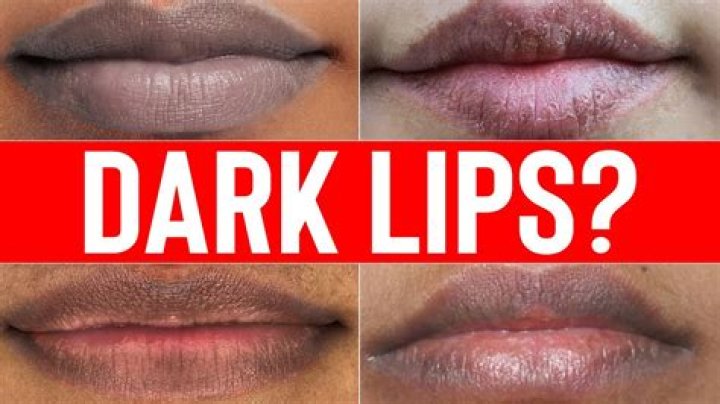 Does lipstick make lips dark?