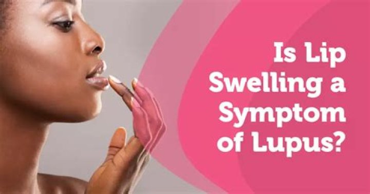 Does lupus affect the lips?
