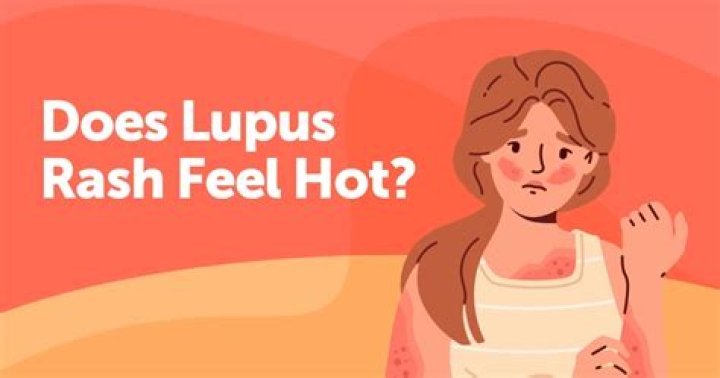 Does lupus cause insanity?