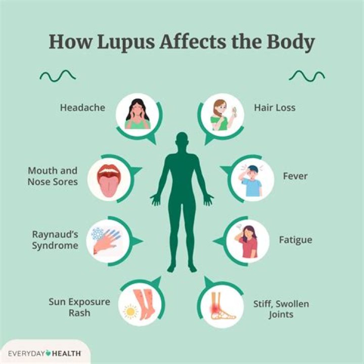 Does lupus make you feel hot?