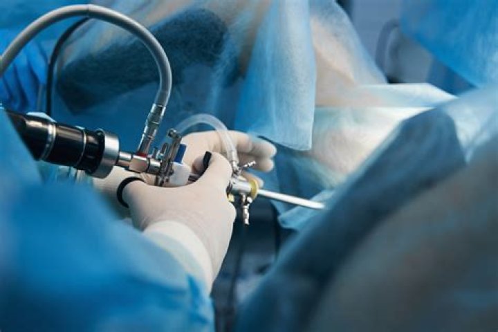 Does Medicare cover a frenectomy?
