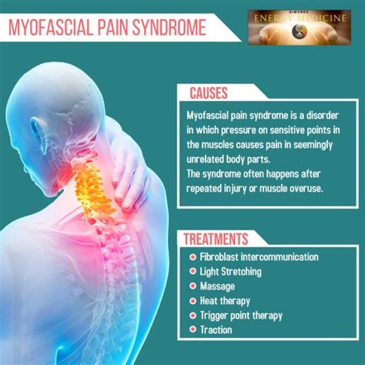 Does myofascial pain syndrome ever go away?