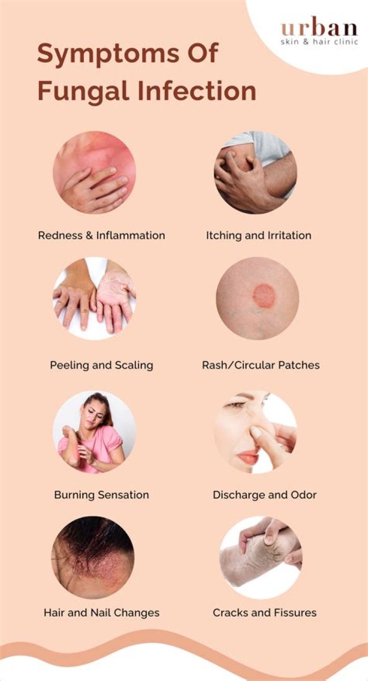Does Salt Water Help fungal infections?