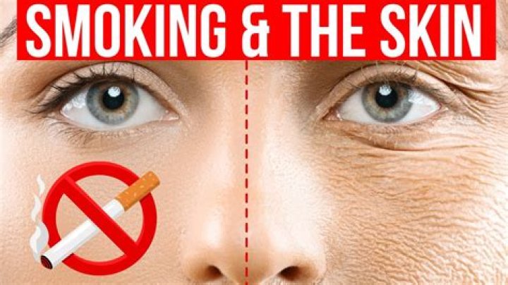 Does smoking give you a belly?