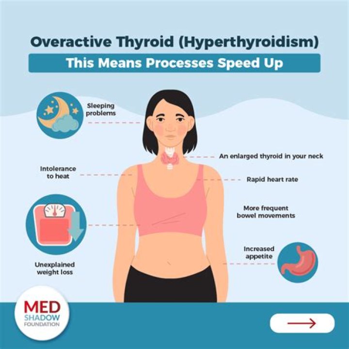 Does thyroid cause cough?