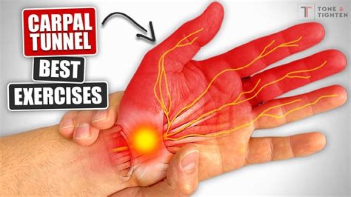 Does Vitamin D Help carpal tunnel?