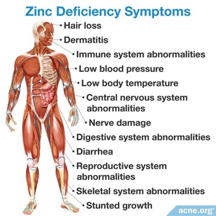 Does zinc cause skin purging?
