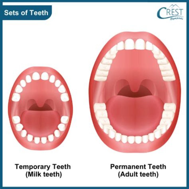 Has anyone had 3 sets of teeth?