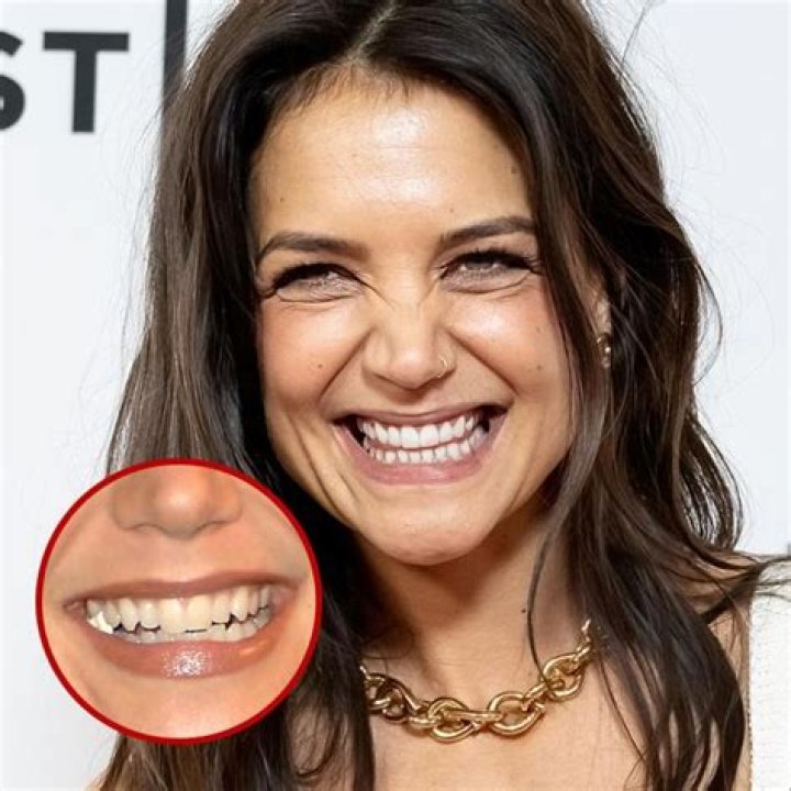 How are celebrity teeth so white?