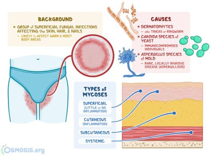 How can I cure infection in my body?