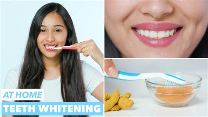 How can I get whiter teeth?