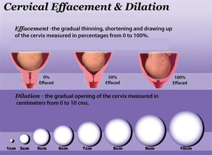 How can I soften my cervix at home?