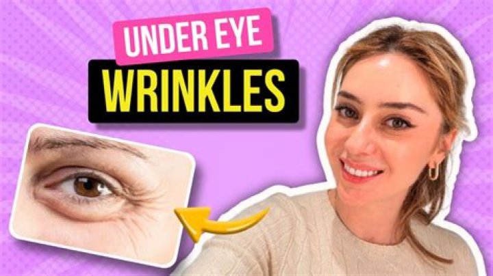 How can I soften under eye wrinkles?