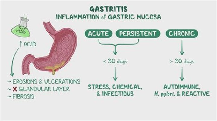 How can I speed up the healing of gastritis?