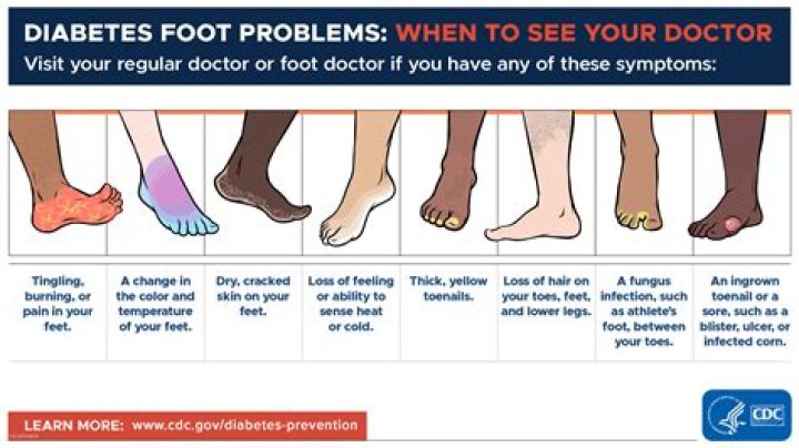 How can I tell if I have diabetes without going to the doctor?