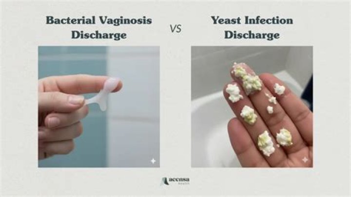How can I tell the difference between BV and yeast infection?