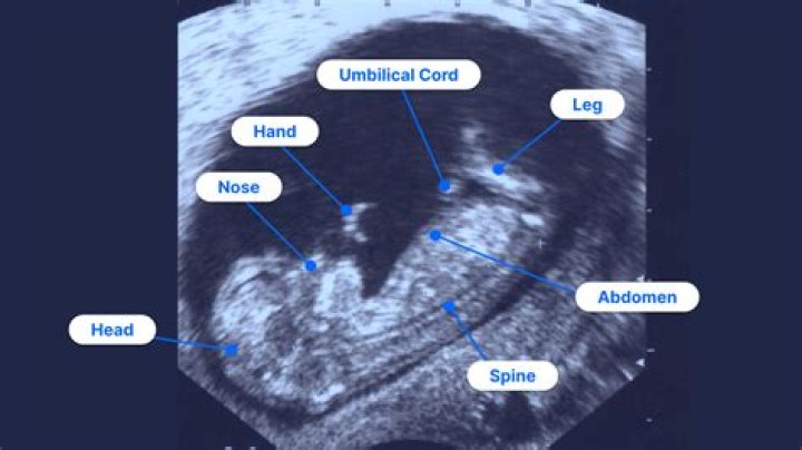 How can you tell if baby is head down without ultrasound?