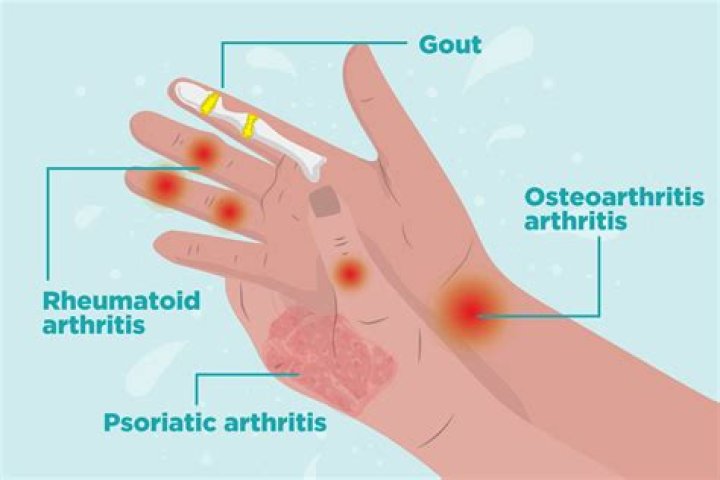 How can you test for rheumatoid arthritis at home?
