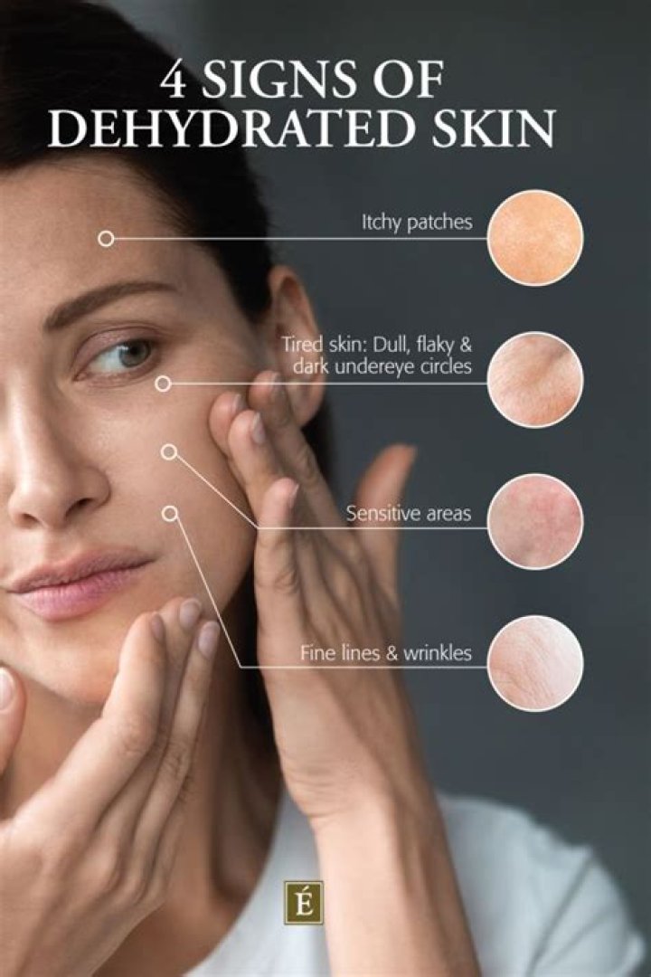 How do you check if you are dehydrated on skin?