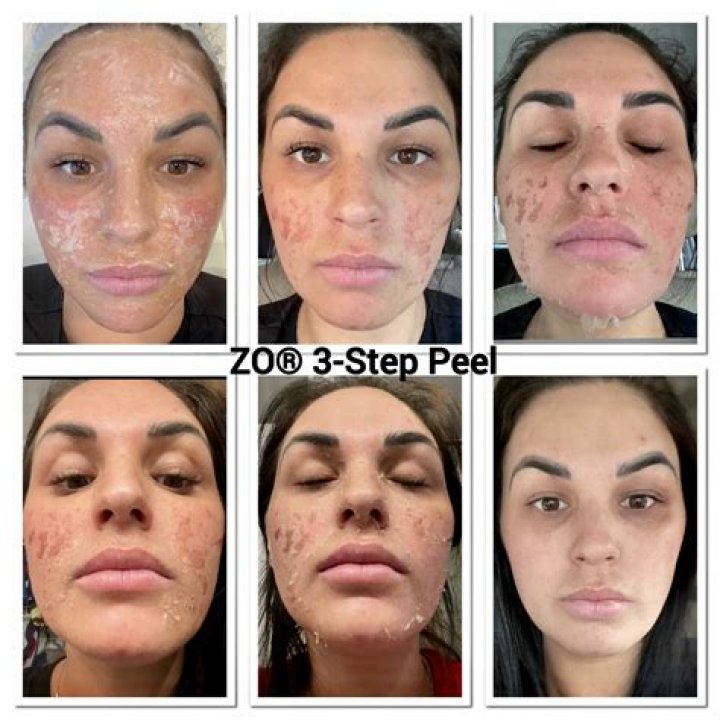 How do you do a peel out?