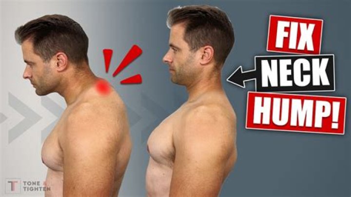 How do you fix aging neck?