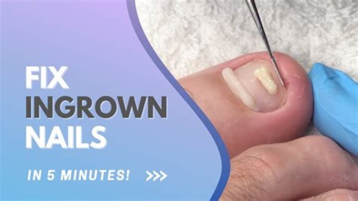How do you fix aging toenails?