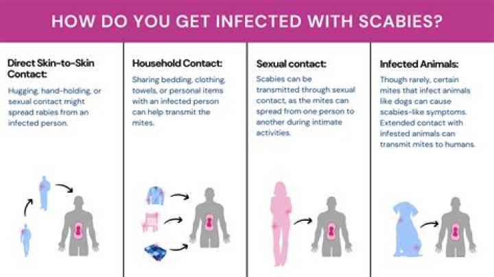 How do you get lice without human contact?