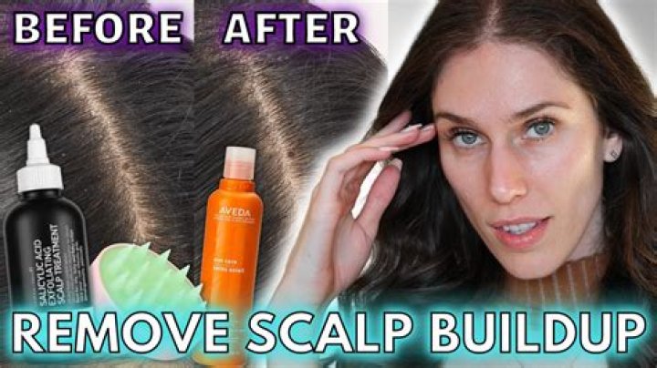 How do you get rid of buildup in starter locs?