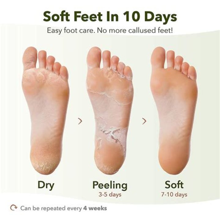 How do you get rid of hard skin on your feet fast?