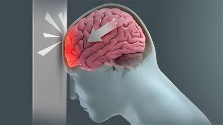 How do you know if your brain has an infection?