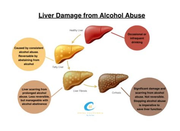 How do you know if your brain is damaged by alcohol?