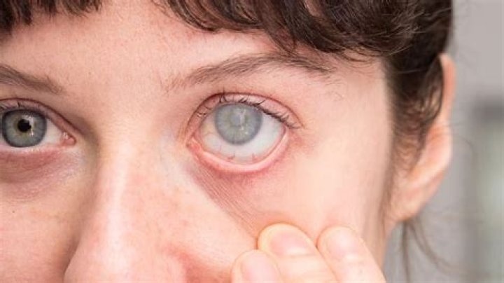 How do you know if your eyes are going bad?