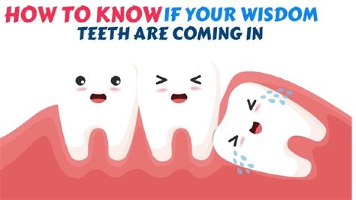 How do you know if your wisdom teeth are rotting?