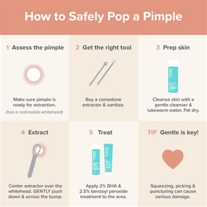 How do you pop a pimple with a pin?