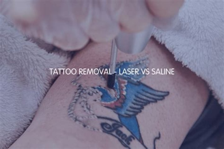 How do you remove a tattoo with salt?